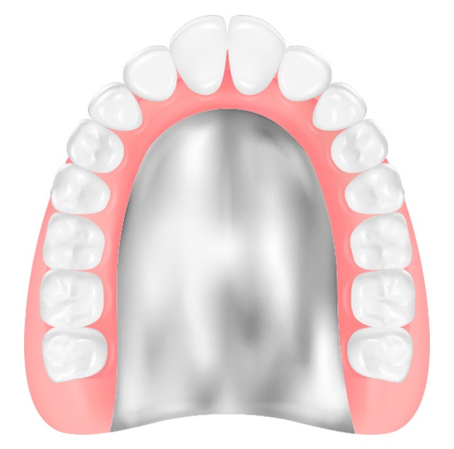 総入れ歯(金属床義歯)