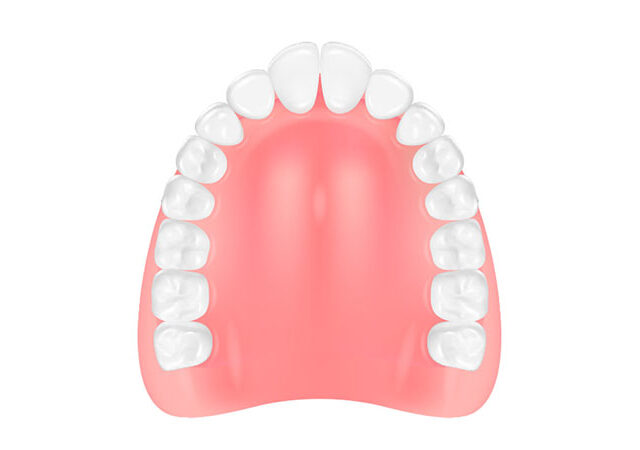 部分入れ歯(コンフォート)